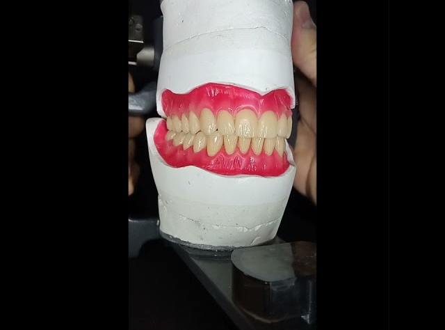 Dentures